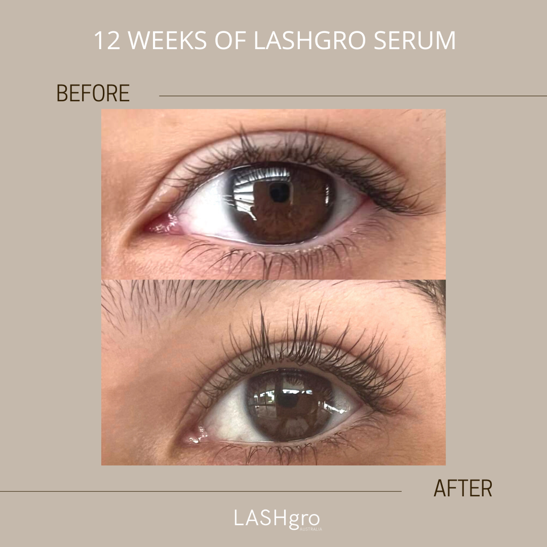 LASHgro Eyelash Growth Serum