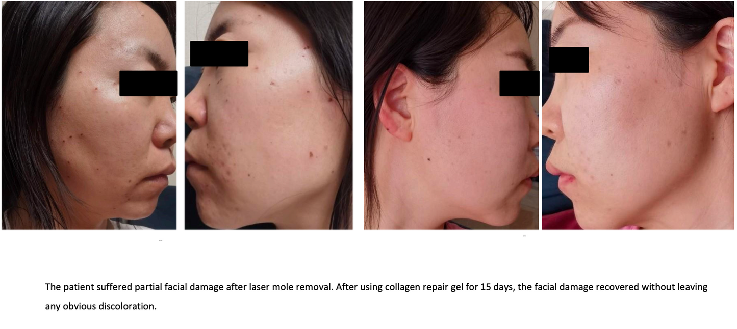 Collagen Gel Dressing Spray 30g