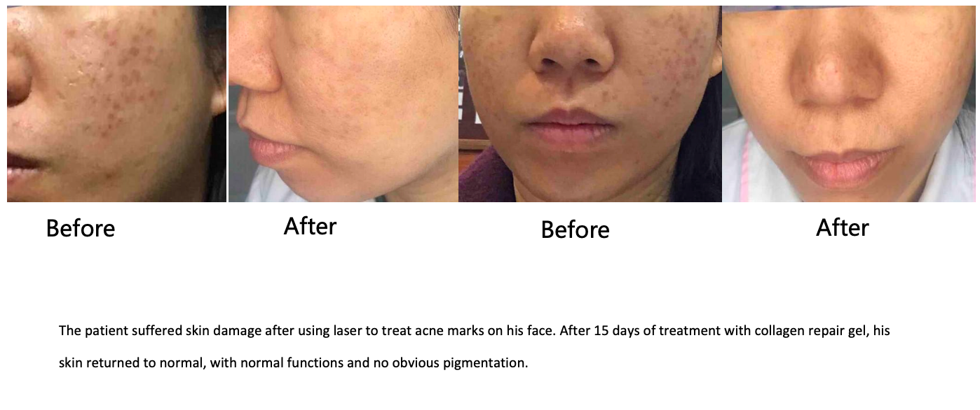 Collagen Cream Dressing - 20g