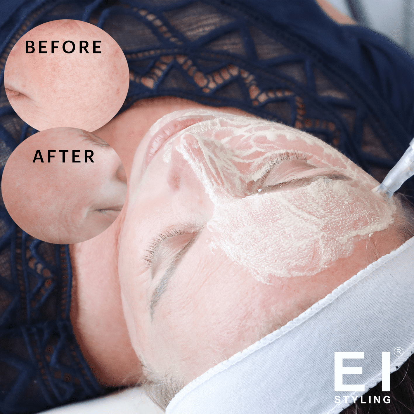 *AUTHENTIC* Stayve BB Glow Serum - Light Rose (10 x 8ml)