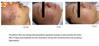 Collagen Repair Spray 30ml